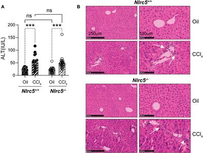 NLRC5 Deficiency Deregulates Hepatic Inflammatory Response but Does Not Aggravate Carbon Tetrachloride-Induced Liver Fibrosis